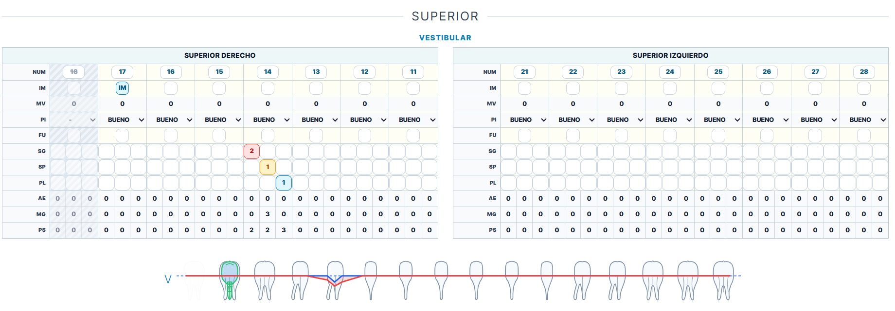 Periodontograma de CtrlDental